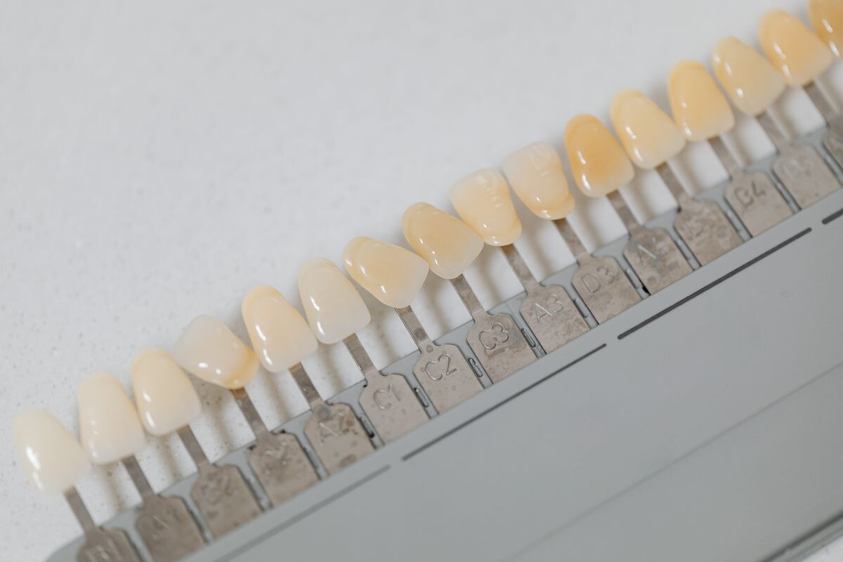 Tooth Bleaching